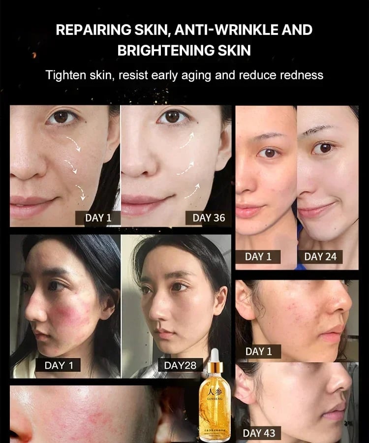 🔥LAST DAY 49% OFF🔥 Ginseng Polypeptide Anti-Ageing Essence-The Secret of Youth