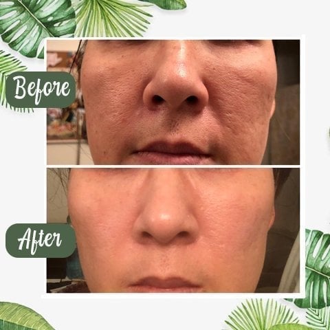 🍵Buy 1 Get 1 Free🍵 Deep Cleanse Green Tea Mask