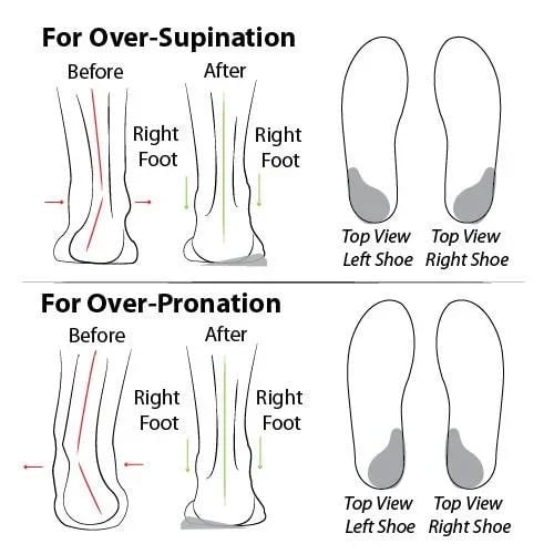 🔥49%🔥2024 Women Casual Summer Daily Comfy Slip On Sandals