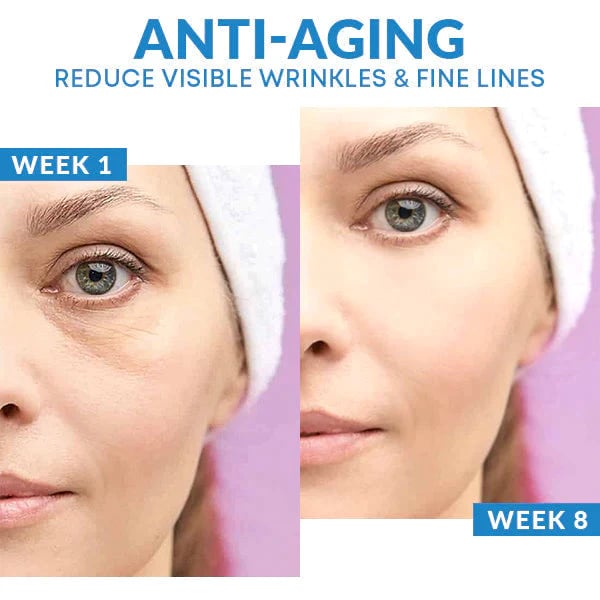 Puffiness & Dark Circles Reducing Under-Eye Cream